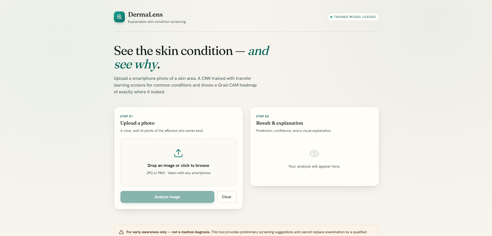 ClaudeDerma AI – Skin Condition Detection System screenshot